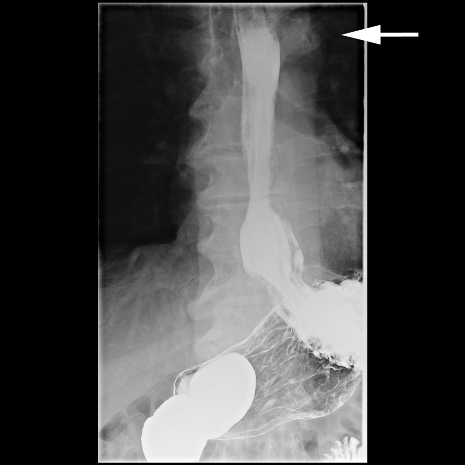 Barium Swallow HOW TO BSGAR